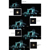 Tiffen : Picture 2 thumbnail